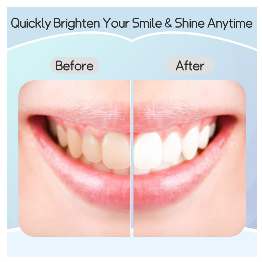 Teeth Whitening Strips